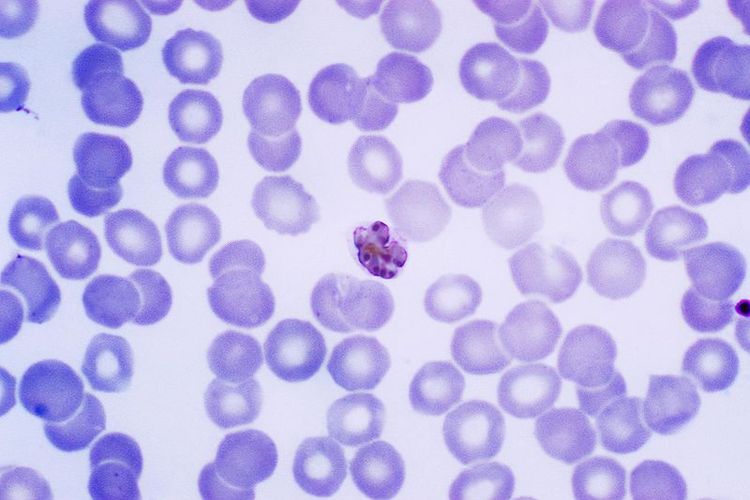 Plasmodium malariae schizont, salah satu protozoa penyebab malaria