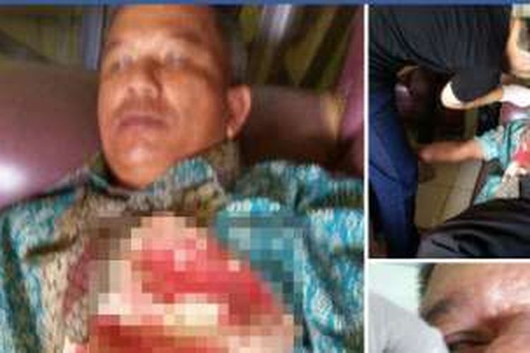 Foto kepala sekolah SDN 37, Husin yang menjadi korban penganiayaan yang dilakukan oleh Mansyur yang diunggah akun Facebook Jurnalis Warga Kubu Raya yang beredar viral di media sosial (11/9/2016)