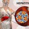 9 Gejala Hepatitis B yang Pantang Disepelekan