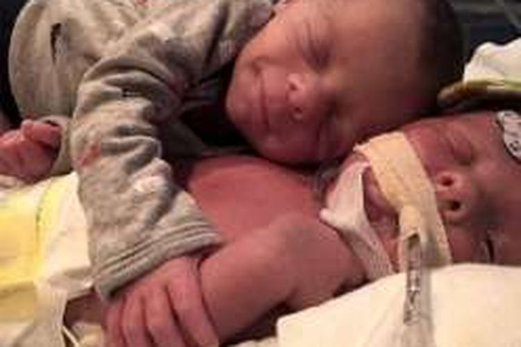 Dalam gambar ini, bayi baru lahir, Mason, memeluk saudara kembarnya, Hawk, yang sedang menderita sakit karena kelainan bawaan dan foto ini menjadi viral di media sosial. Namun, sayangnya kisah bayi kembar di Florida, AS, ini berakhir dengan kesedihan, yakni Hawk meninggal.