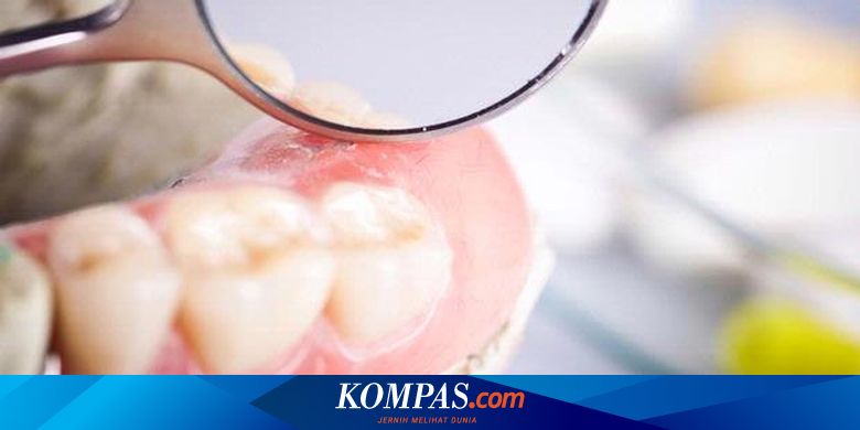 Pusing Berat Sebelum Dan Setelah Cabut Gigi