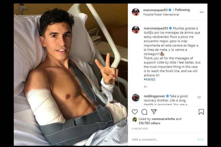 Kondisi Marc Marquez pasca operasi ketiganya