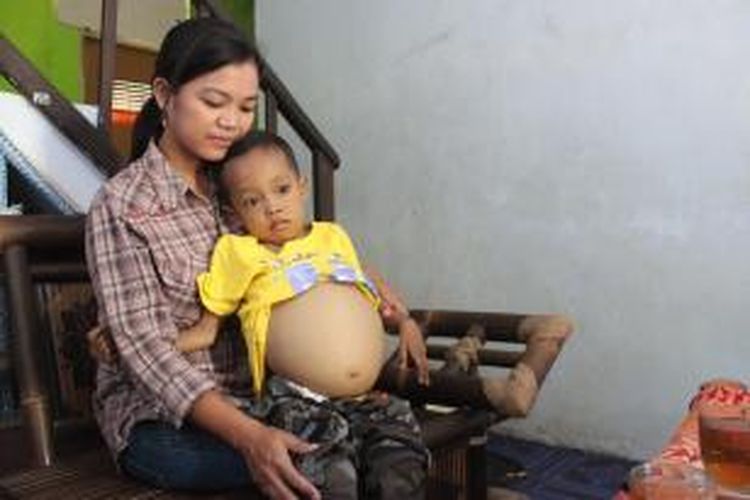 Ferdian Tri Pamungkas, dipangku sang Ibu. Belum diketahui diagnosa penyakitnya, tetapi perut balita ini terus membesar hingga tak mampu berjalan.