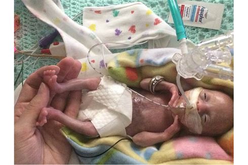 Berkat Sains, Bayi Paling Prematur di Dunia Kini Berusia 3 Tahun