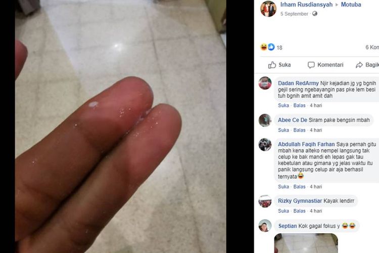 Sebuah unggahan bernarasikan jari tangan seseorang terkena lem hingga merekat satu sama lain, viral di media sosial.
