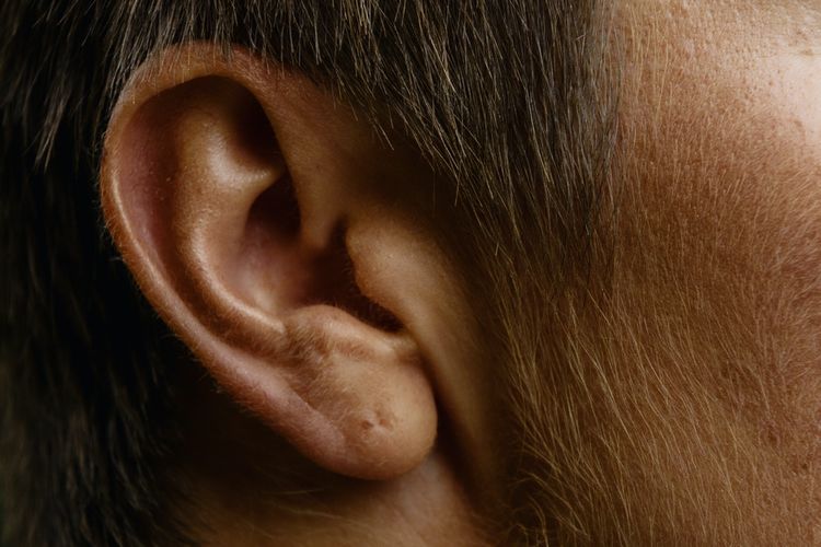 Komplikasi gendang telinga pecah seperti gangguan pendengaran kronis. Itu mungkin terjadi, jika kondisi ini gagal sembuh sendiri setelah 3-6 bulan.