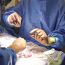 Terobosan Ahli Bedah AS: Transplantasi Ginjal Babi pada Manusia