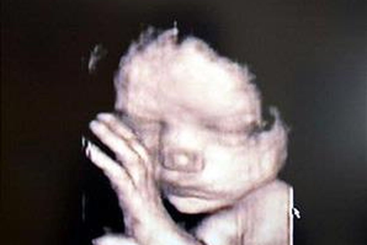 Citra janin bayi dalam kandungan melalui alat   ultrasound tiga dimensi. 