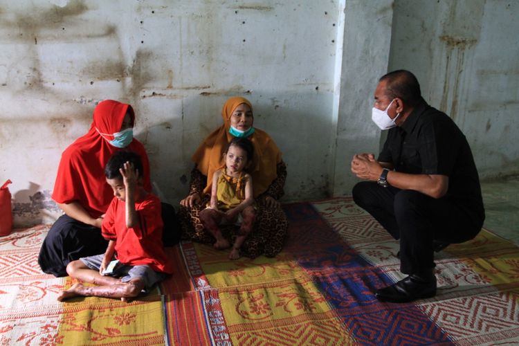 Gubernur Sumut, Edy Rahmayadi menjenguk Haikal dan Zakira, dua bocah penderita penyakit kulit aneh di Medan, Minggu (4/7/2021).