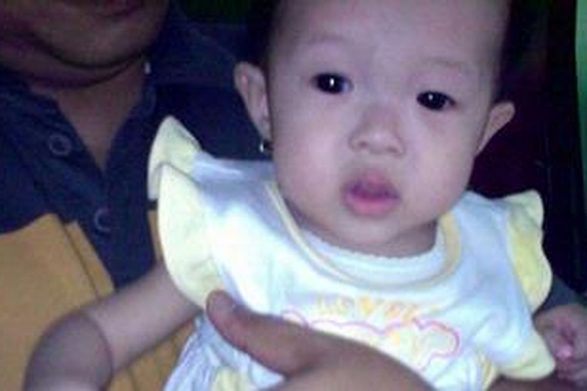 Maureen, bayi berusia 8 bulan, diduga mengalami tindak malpraktek yang menyebabkan dua ruas jari sebelah kanan putus.