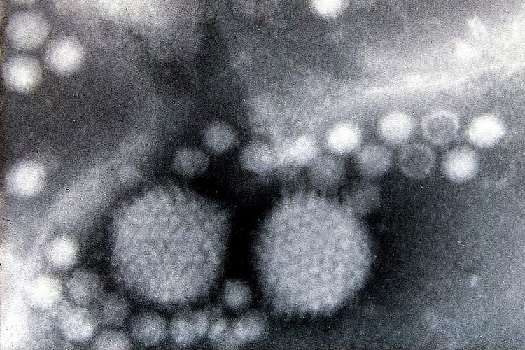 Gambar virus flu musiman, adenovirus. Ilmuwan menemukan DNA virus flu musiman purba pada gigi susu berusia 31.000 tahun, dari manusia modern (Homo sapiens).