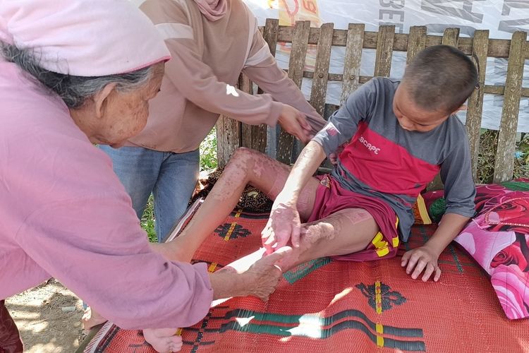 Urutan Kejadian 3 Santri di Lombok Tengah Diduga Dibakar Senior, Berawal dari Kamar Kosong yang Dikunci