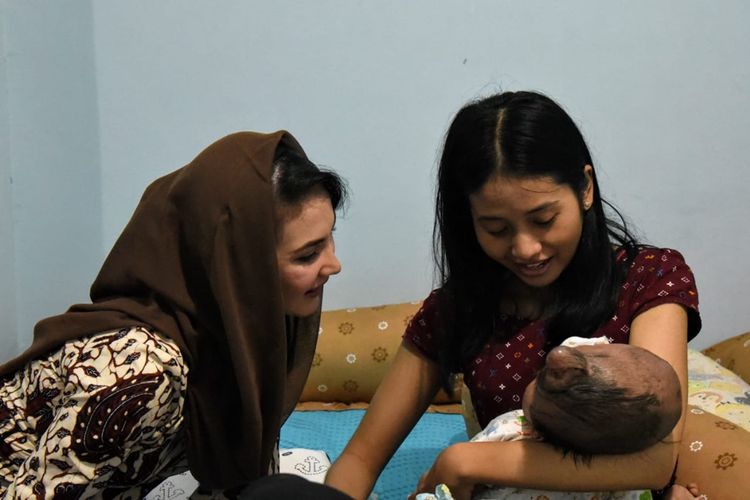 Arumi Bachsin menjenguk Pandu, bayi Hydrocypalus rusak wajah di Rusun Gunungsari Surabaya, Jumat (6/12/2019)