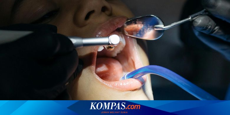 Cara Pasang Gigi Palsu dengan BPJS Kesehatan: Syarat dan Prosedur