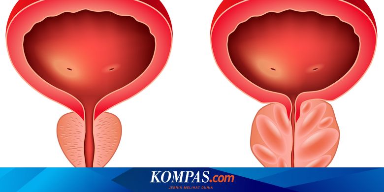 a prosztatitis kezelés a népi módszerrel a prosztatitis harmónia kezelése