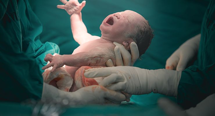 Mengapa Bayi Menangis Sesaat Setelah Lahir?