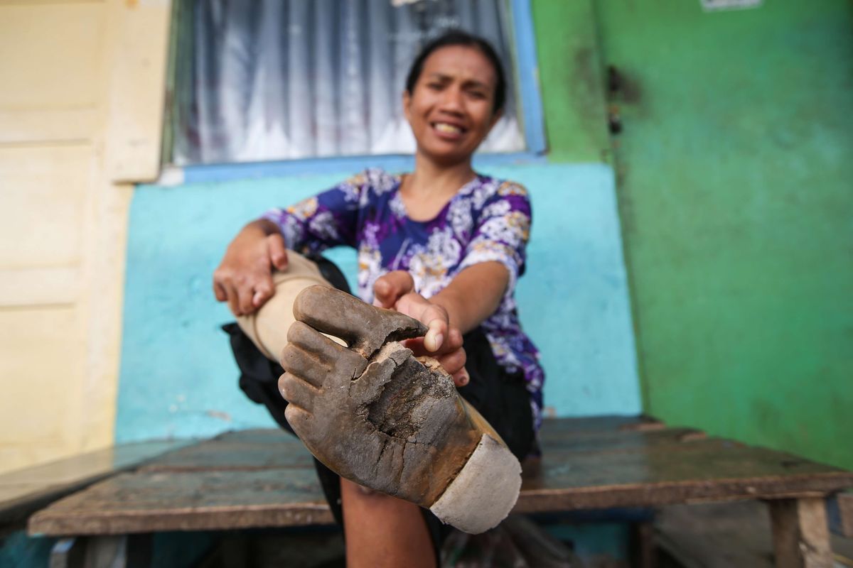 Juleha (34), eks penderita penyakit kusta menunjukkan kaki palsunya yang sudah rusak di Kampung Sitanala, Kelurahan Karangsari, Kecamatan Neglasari, Kota Tangerang, Banten, Selasa (20/8/2019). Di kampung yang berada di belakang RS dr. Sitanala ini dihuni sekitar 1000 eks penderita kusta dan keluarganya.