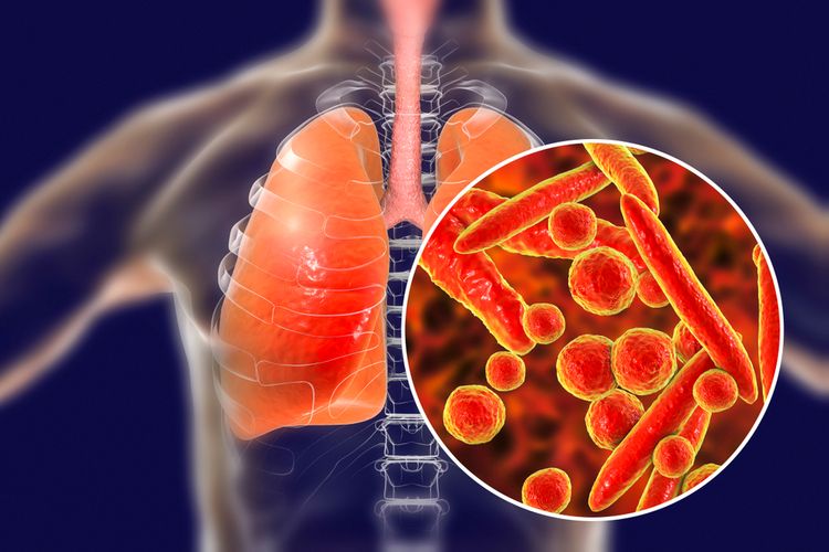 Ilustrasi Mycoplasma pneumoniae, bakteri penyebab pneumonia pada manusia.