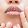 6 Obat Alami untuk Mengatasi Bibir Pecah-pecah