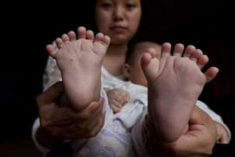 Bayi Laki Laki Di China Memiliki 31 Jari Tangan Dan Kaki Halaman All Kompas Com