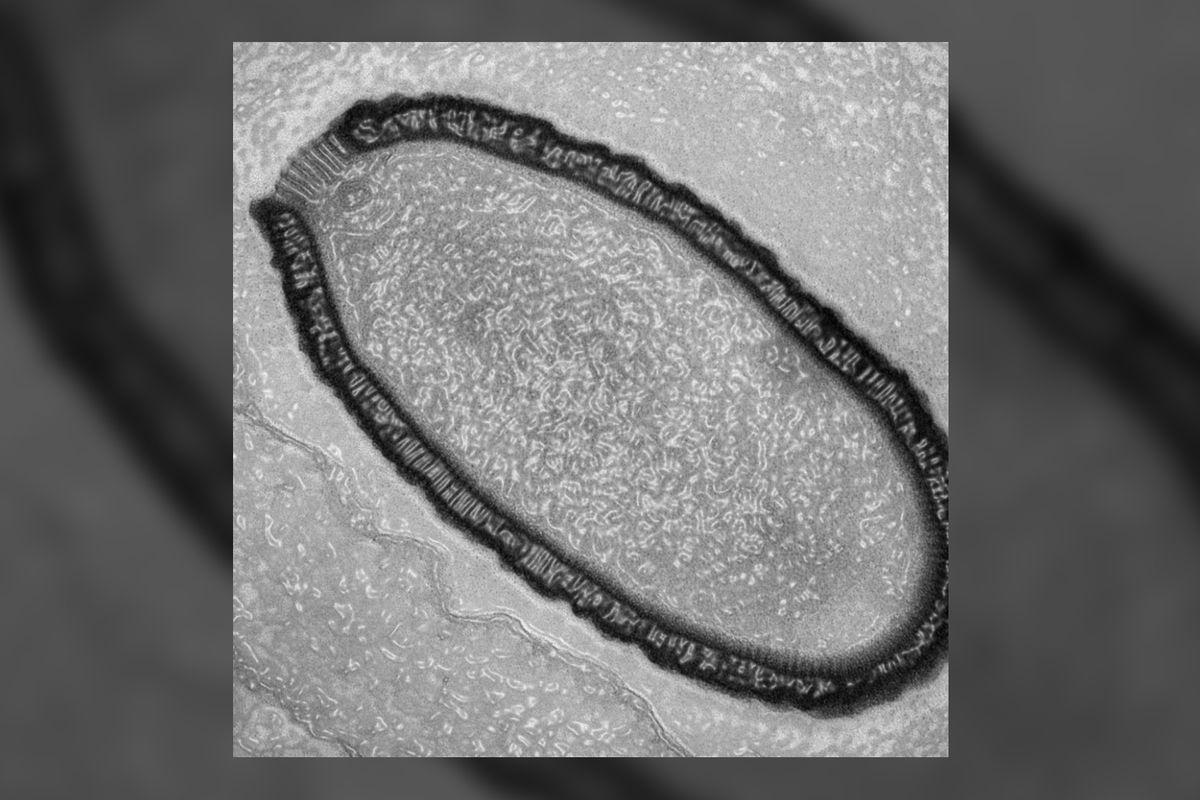 Virus Pithosvirus sibericum adalah salah satu virus zombi kuno yang ditemukan di permafrost Siberia dan mencoba dibangkitkan kembali oleh para ilmuwan.