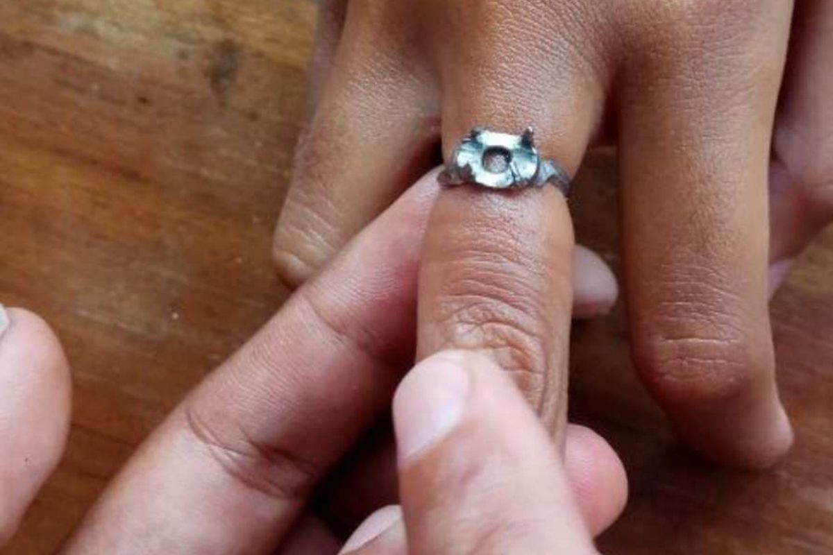 Cincin di jari seorang anak perempuan yang tersangkut dan dibantu dilepaskan oleh Suku Dinas Penanggulangan Kebakaran dan Penyelamatan Jakarta Utara, Jumat (19/1/2018).