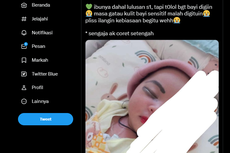 Viral, Foto Bayi Dirias dengan Kosmetik Tebal, Apa Bahayanya?