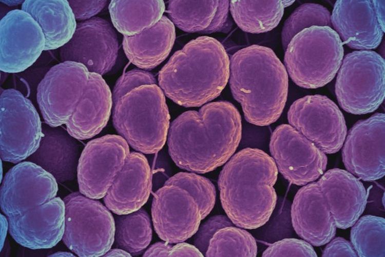 Bakteri Neisseria gonorrhoeae, penyebab infeksi menular seksual Gonore atau kencing nanah