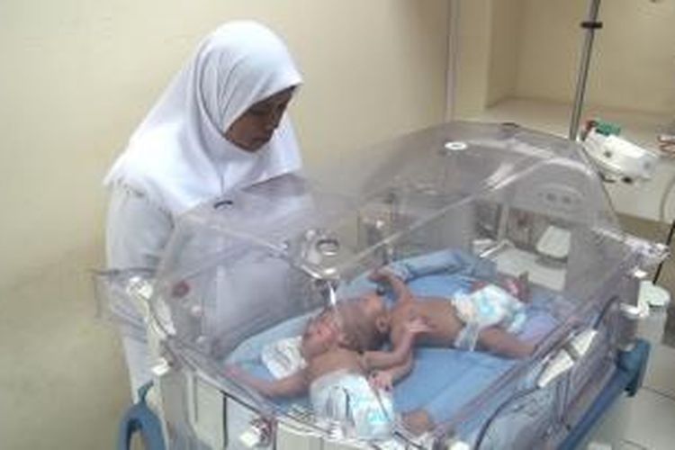 Bayi Kembar siam Fitri Sakinah dan Fitri Rahmawati yang kini berusia satu bulan asal Kutacane, Aceh Tenggara akan dirujuk ke RS dr Sarjito Jogjakarta untuk menjalani operasi pemisahan kepala pada akhir bulan ini. Keduan lahir dengan kondisi prematur pada 2 Mei 2015 lalu.*****K12-11