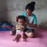 Mari Berdonasi untuk Apriani, Bocah 1 Tahun Asal Flores NTT yang Idap Hidrosefalus