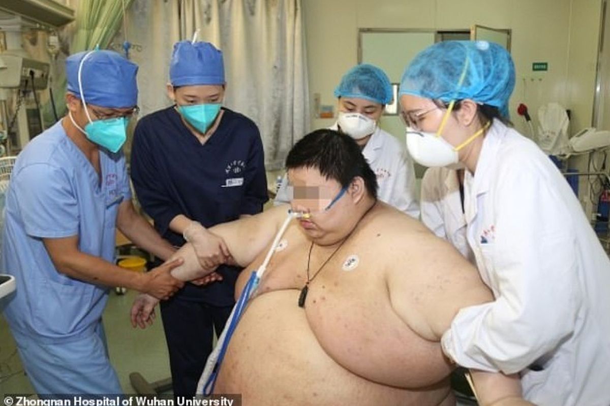 Kondisi Zhou, pria dengan bobot 279 kg ketika ditangani oleh Zhongnan Hospital of Wuhan University. 