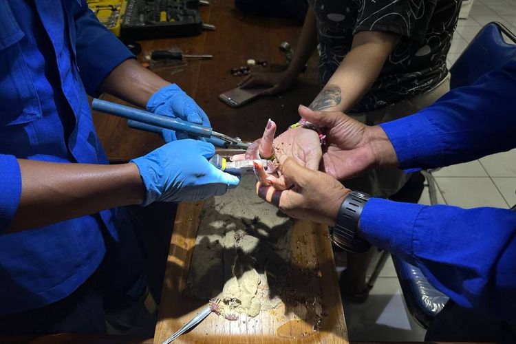 Petugas pemadam kebakaran Trenggalek melakukan evakuasi mara gerinda, yang menyangkut di jari manis seorang warga, Selasa (26/12/2023).