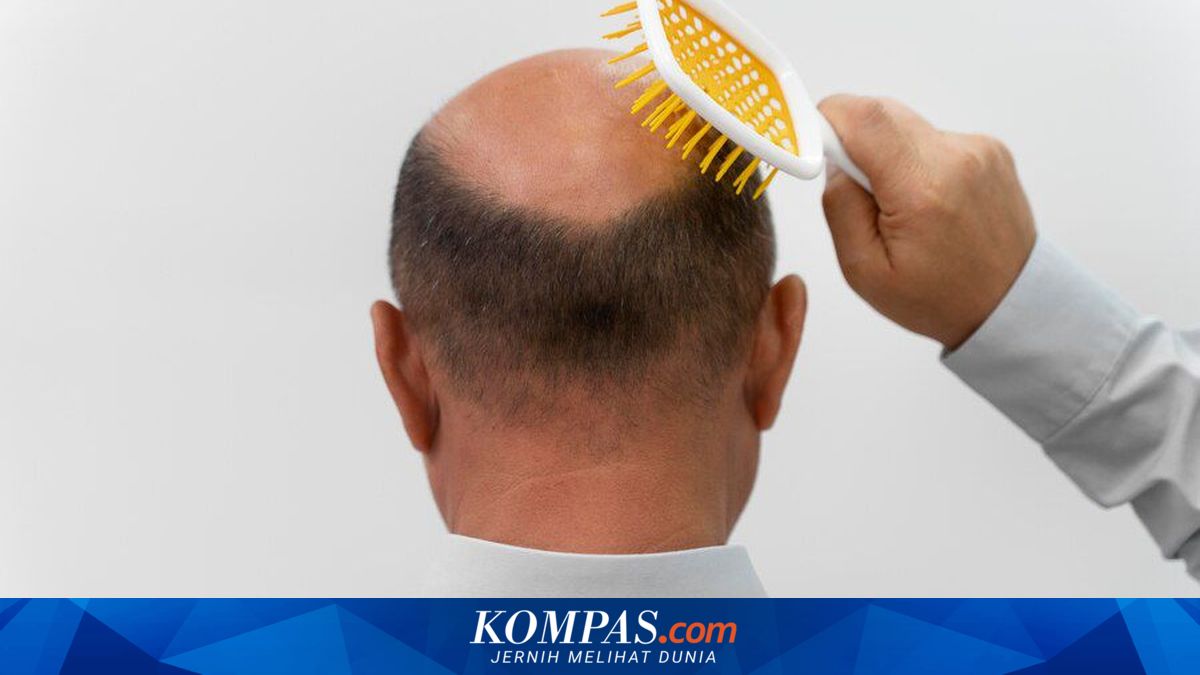 Rambut Rontok Permanen, Coba Atasi dengan 2 Langkah Ini