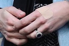 Mengapa Tangan Kate Middleton Sering Terluka? 