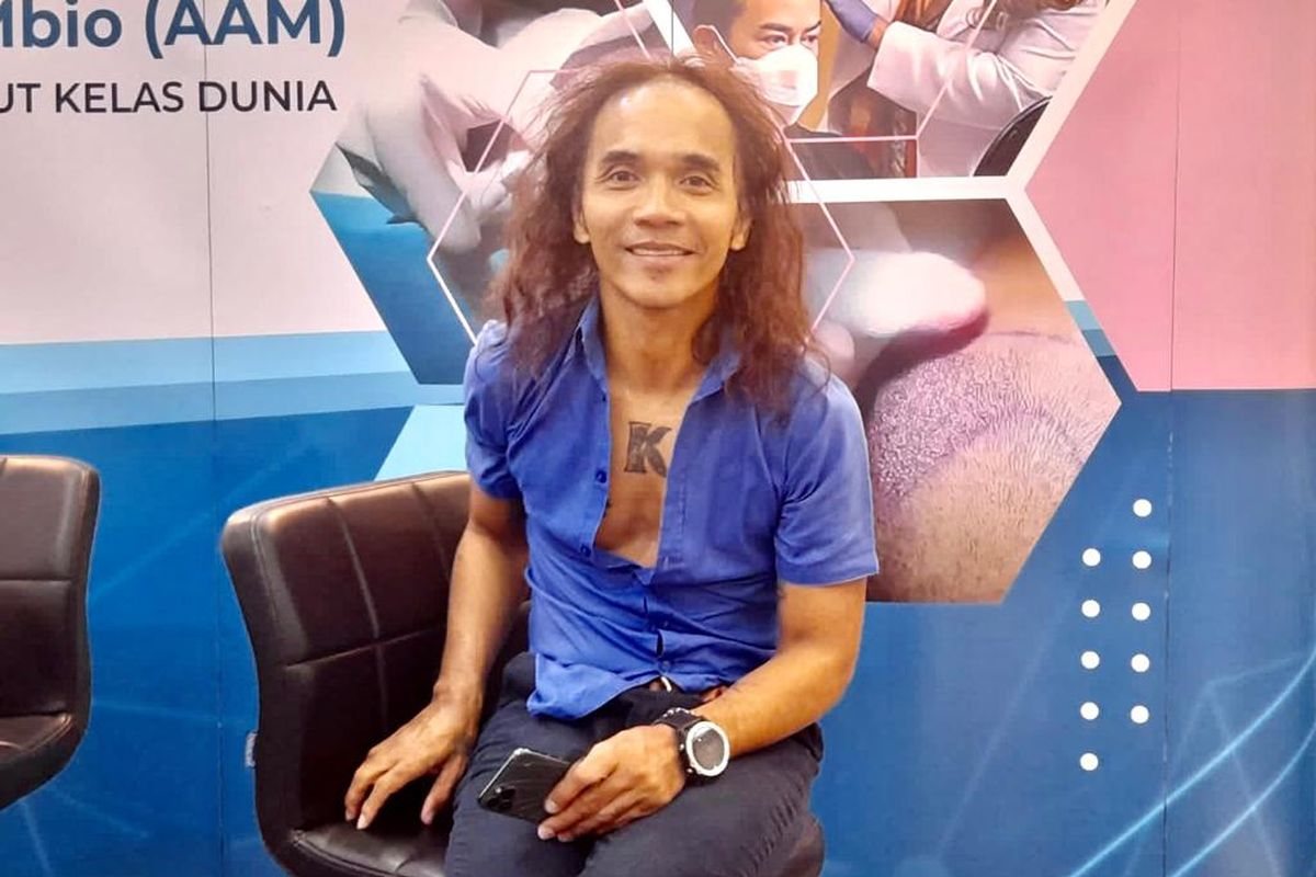 Cerita Kaka Slank transplantasi rambut saat konferensi pers di Farmanina Aesthetic & Hair Clinic, Selasa (24/5/2022).