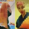Sebar Video TikTok Menari dengan Sisa Operasi Pasiennya, Ahli Bedah Plastik Brasil Diskors