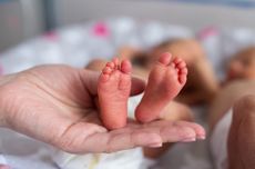 Operasi Pemisahan Bayi Kembar Siam di NTB Tunggu Tim Dokter dari Surabaya