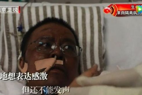 Dokter di Wuhan yang Kulitnya Menghitam Meninggal, Publik China Marah