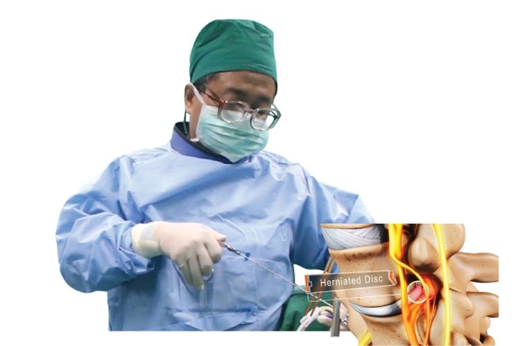 Ilustrasi dr Mahadian Nur Nasution, SpBS.