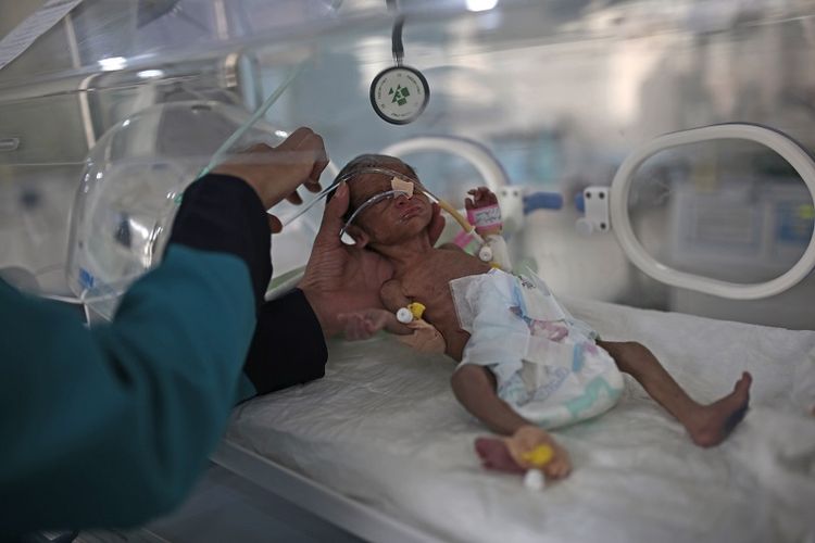 Foto ini diambil pada 27 Juni 2020, seorang petugas medis memeriksa bayi baru lahir yang kekurangan gizi di dalam inkubator di rumah sakit Al-Sabeen di Sana'a, Yaman.