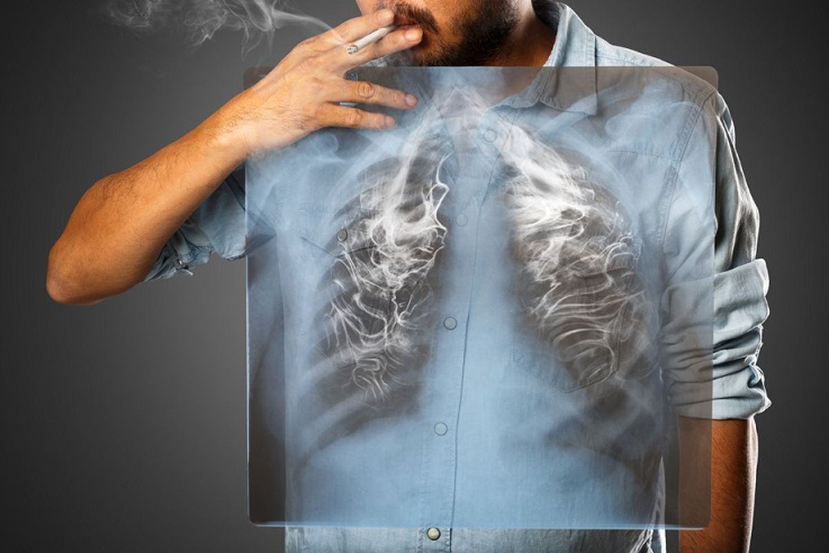Ilustrasi bahaya asap rokok. Penyebab utama kanker paru dan kematian di Indonesia.