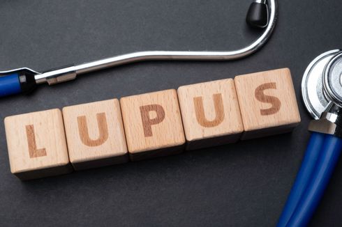 Apakah Penyakit Lupus Bisa Disembuhkan? Berikut Faktanya...