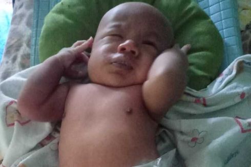 Terlahir Tanpa Anus dan Kelainan Jantung, Bayi Habid Butuh Uluran Tangan