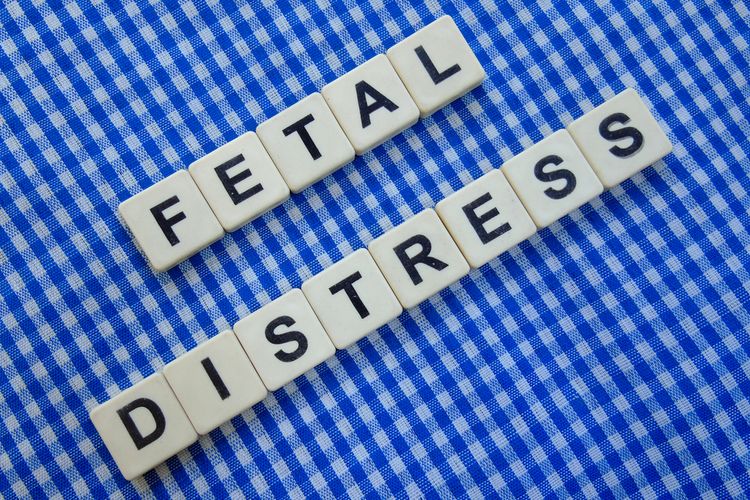 Ilustrasi Fetal Distress atau Gawat Janin