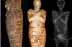 Penemuan Pertama di Dunia, Mumi Wanita Hamil Mesir Kuno 