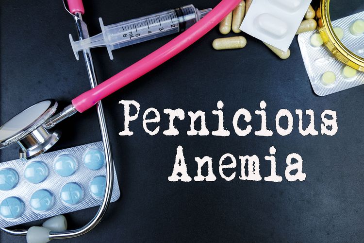 Ilustrasi anemia pernisiosa