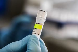 Jakarta Temukan 3 Kasus Hantavirus, WHO Prediksi Kasus Global Masih Akan Bertambah