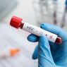 Kasus HIV di Thailand Naik Tajam, Anak Muda Jadi Kelompok Paling Rentan