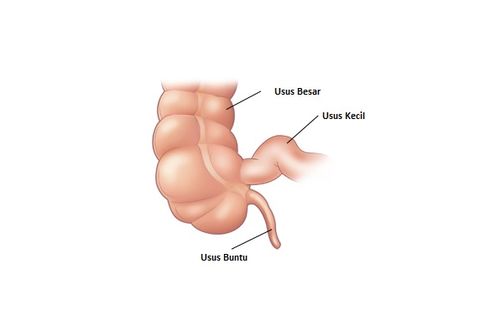 10 Fakta dan Mitos Penyakit Usus Buntu yang perlu Anda Ketahui