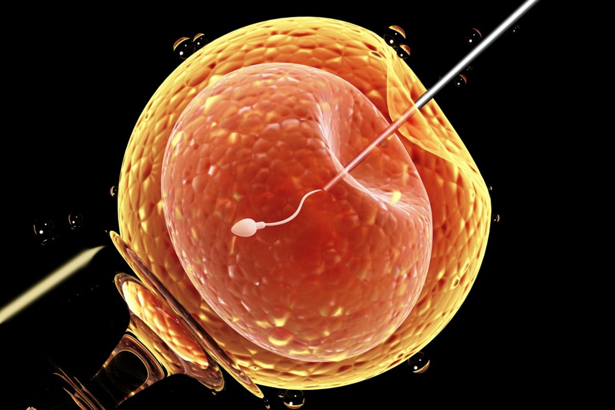 Inseminasi buatan, sperma dipertemukan dengan sel telur. 
